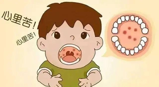 传染性极强！疱疹性咽峡炎进入高发季，5岁以下幼儿注意了