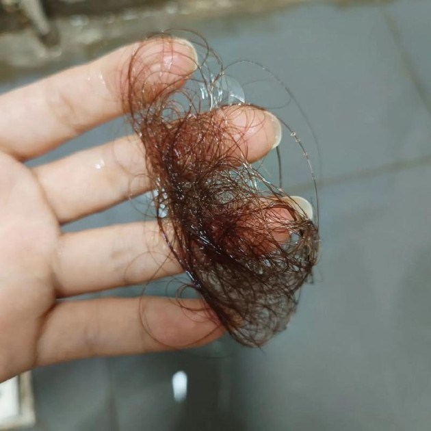 秋风扫落叶，头发也「凋零」？科学应对季节性脱发