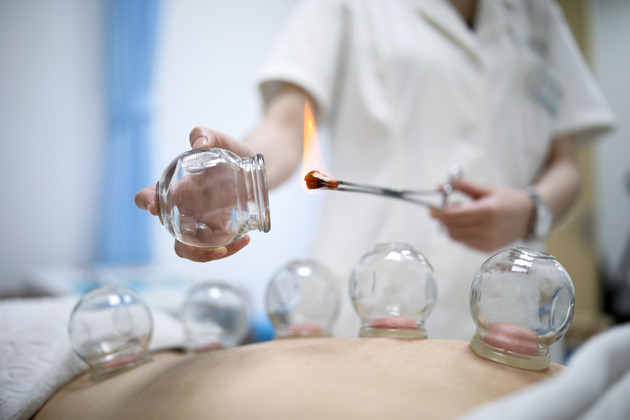 拔罐后皮肤颜色越深，代表“毒”越多？