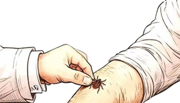市疾控中心：被蜱虫叮咬切勿强行拔虫